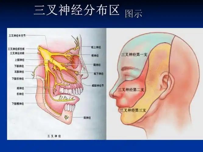 三叉神经痛(讲).ppt