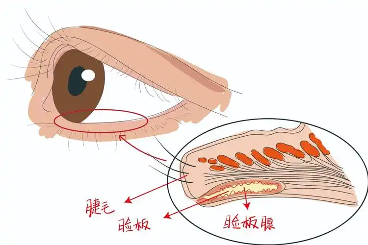 睑板腺开口图片