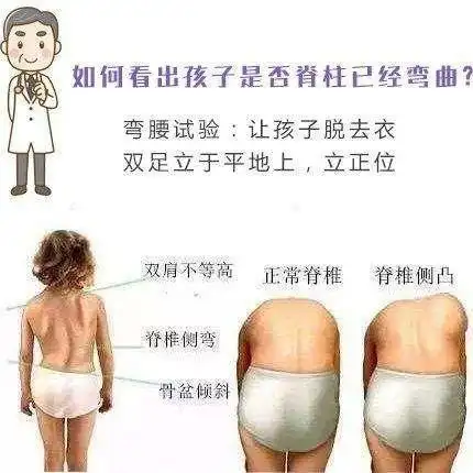 青少年脊柱侧弯,家长要重视了!