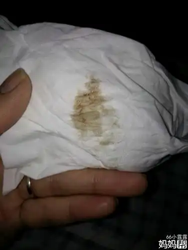 怀孕初期,我总是有褐色分泌物出来,求帮帮我分解