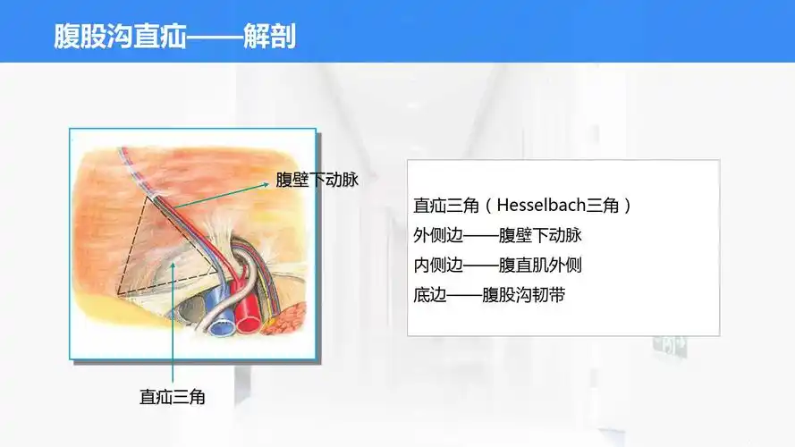 43腹股沟直疝与斜疝的鉴别所属课程外科护理实训指导及习题集