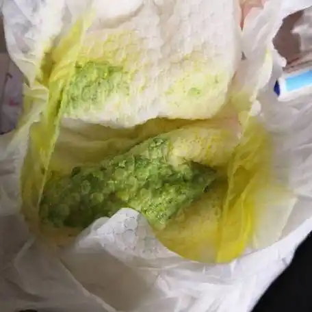 肠道炎症,吃了大量的蔬菜等绿色食品等原因墨绿色大便是典型的肠道