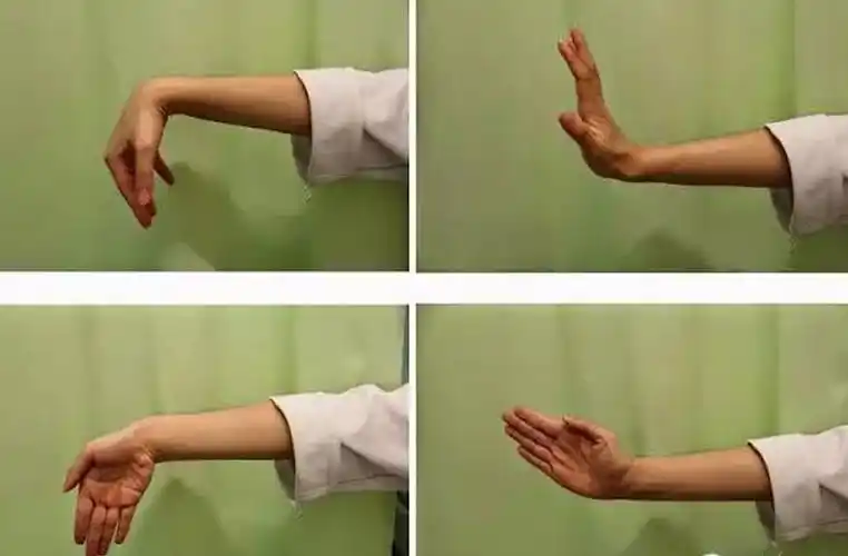 腕关节tfcc损伤康复计划