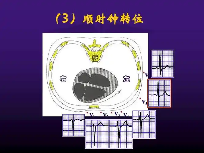 心电图检查和异常心电图图形的识别ppt