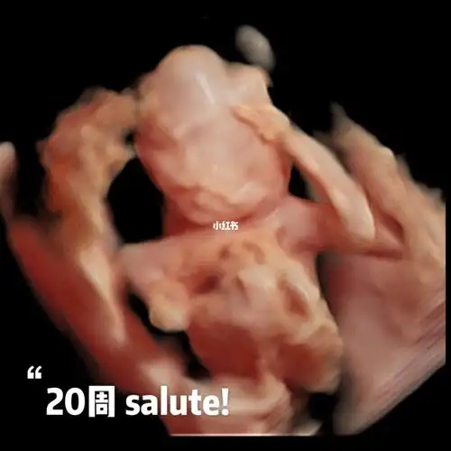 20周宝宝肚里salute笑死了哈哈哈_五维彩超_母婴_孕产经验