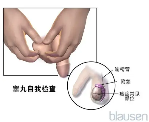 睾丸自我检查