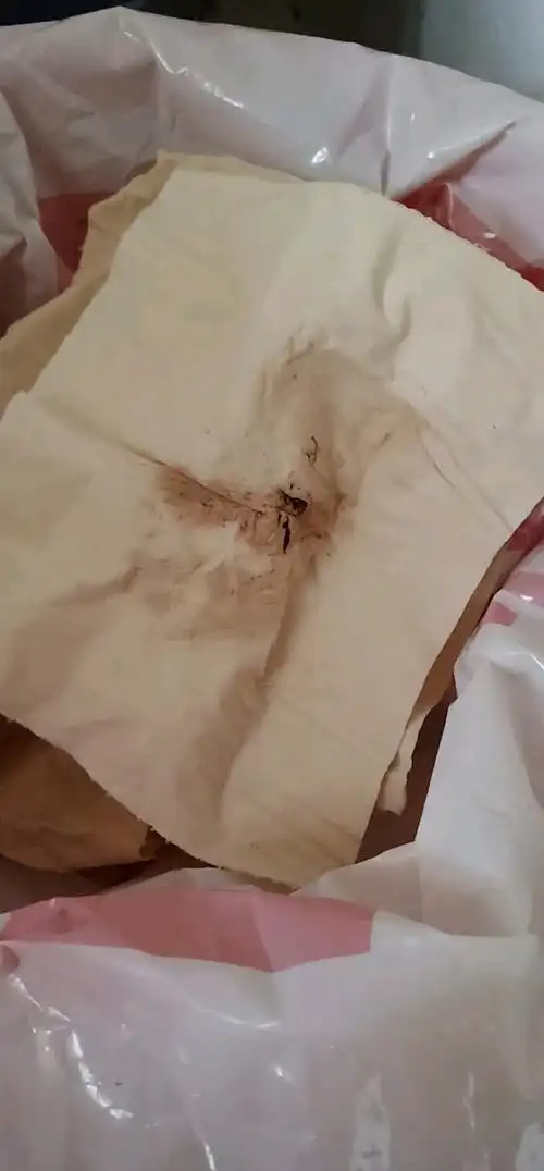 下面褐色的是什么