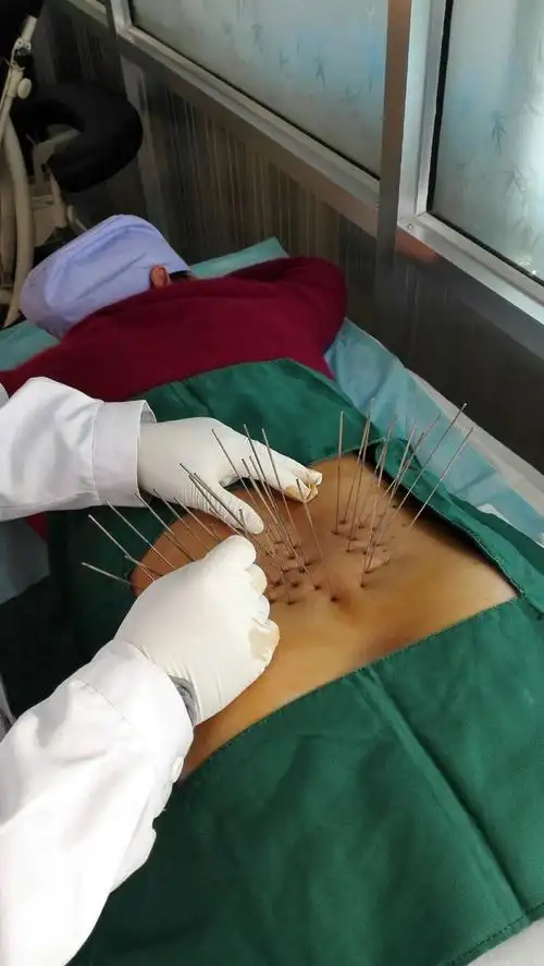 吴忠康复专科医院开展银质针骨骼肌松解术治疗腰椎间盘突出症取得了