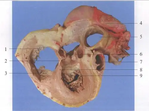 (图) 心的横切面 (经冠状沟平面)