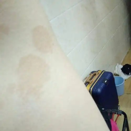 请问下我左右边腋下出现这种暗黄块形状的是什么,不痛不痒的,也没有去