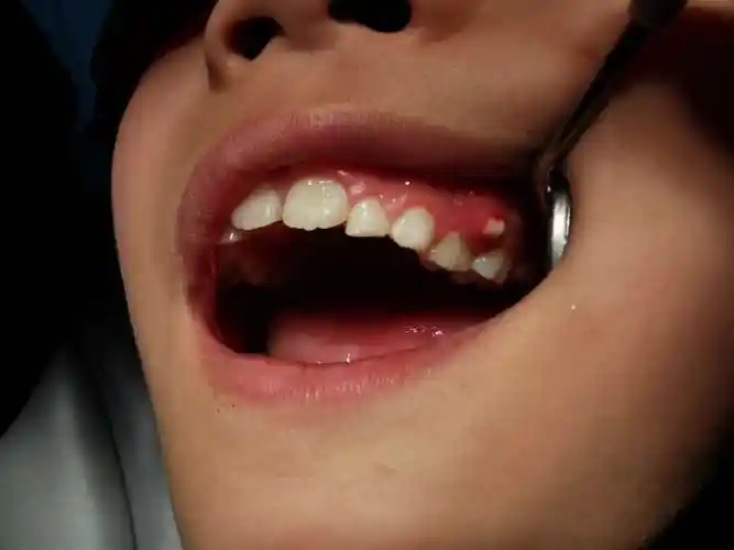 这些地方没有刷干净啊,牙齿和牙龈的交界处,牙齿的表面,牙齿的邻面.