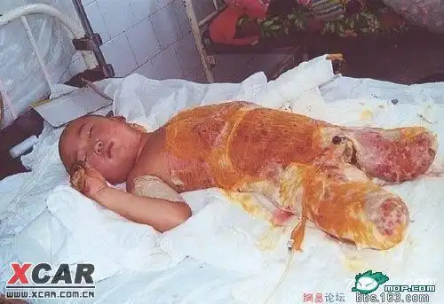 丧心病狂!河南鹿邑蛇蝎毒妇制造惊天惨案