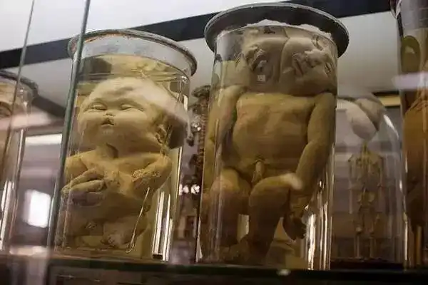 人体标本展厅里不光有被福尔马林浸泡的器官标本,还有各种时期的婴儿