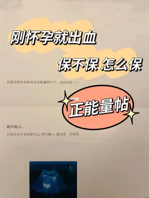 刚怀孕就出血 保不保 怎么保(正能量帖)