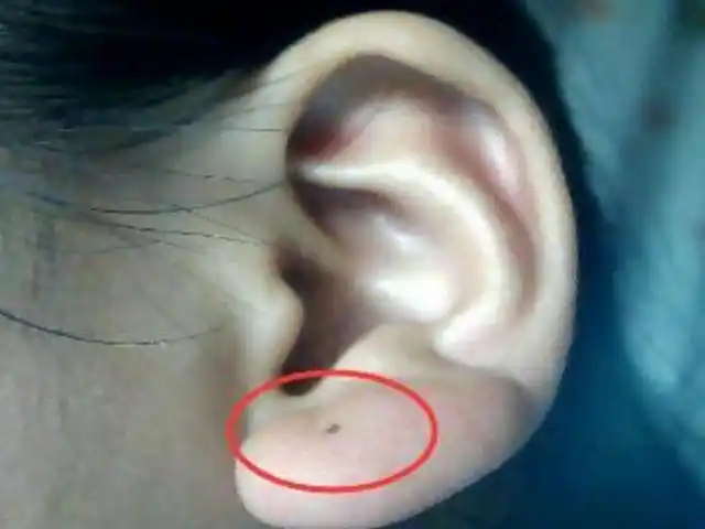 此处只要有发财痣一个痣比一个痣值钱这个痣代表了好福气