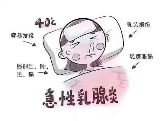急性乳腺炎的中西医辩证及调理方法