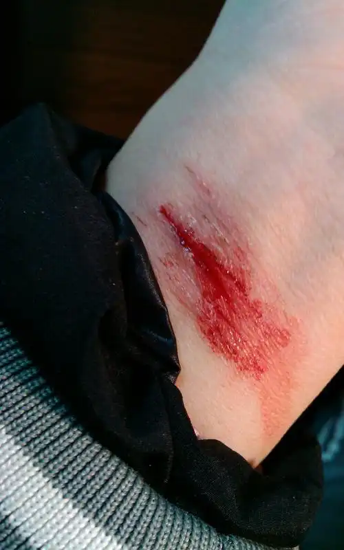 美工刀在不断地撕裂开我的手腕上最细嫩的皮肤,殷红的血不断地向外涌