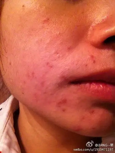 谁知道这种情况到底是怎样?