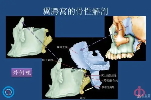 专业资源翼腭窝的解剖影像和临床