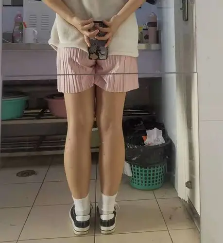 姐妹们能帮我看下我这属于小腿肌肉外翻吗应该怎么减啊我还有救吗