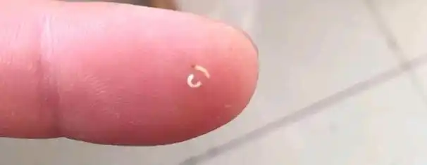 为什么现代人的牙不如前人的好?