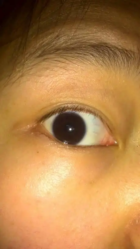 黑眼珠外面一圈感觉有点扩散,边缘有点像银灰色,我是近视.