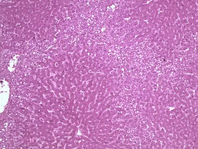 病理学切片5