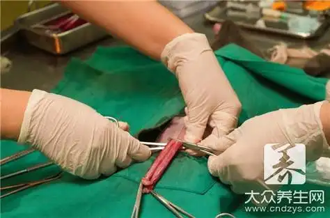 对于已经没有生育要求的男性来说,结扎手术是比较常见的一种避孕方式.