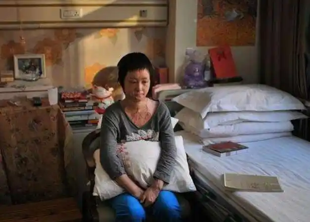 这时,电视里正在播放任家萱的采访,任家萱曾在拍戏时不幸被烧伤,身上