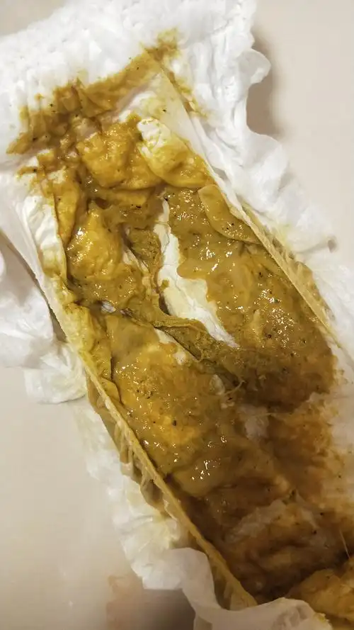 一岁两个月宝宝拉肚子,大便稀水带粘液,请问该怎么办?