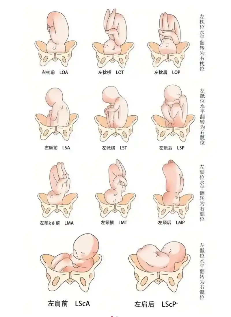 34周77了,33周产检枕前横位就是 - 抖音