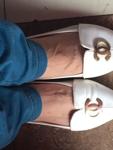 脚背上的血管凸出来很高又不觉得痛,是什么原因