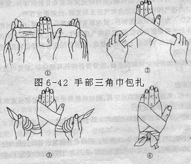 将带状三巾的中段紧贴手掌,将三角巾在手背交叉,三角巾的两端绕至手腕