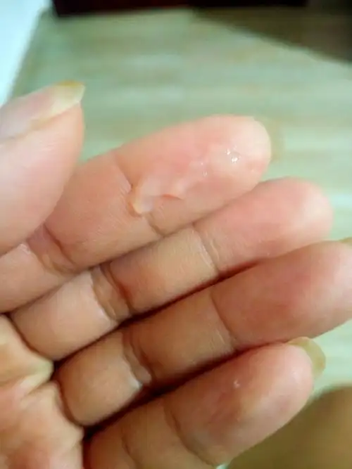 还有一天就是排卵期了,今天洗澡排出来的是不是卵子像蛋清一样能拉丝