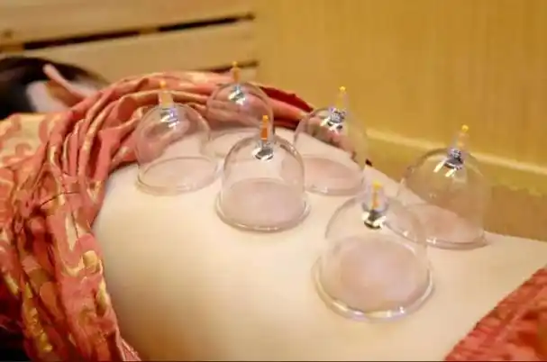 大家通常都会发现在理疗店见到拔罐的基本都是男性,年龄在20-50岁不等