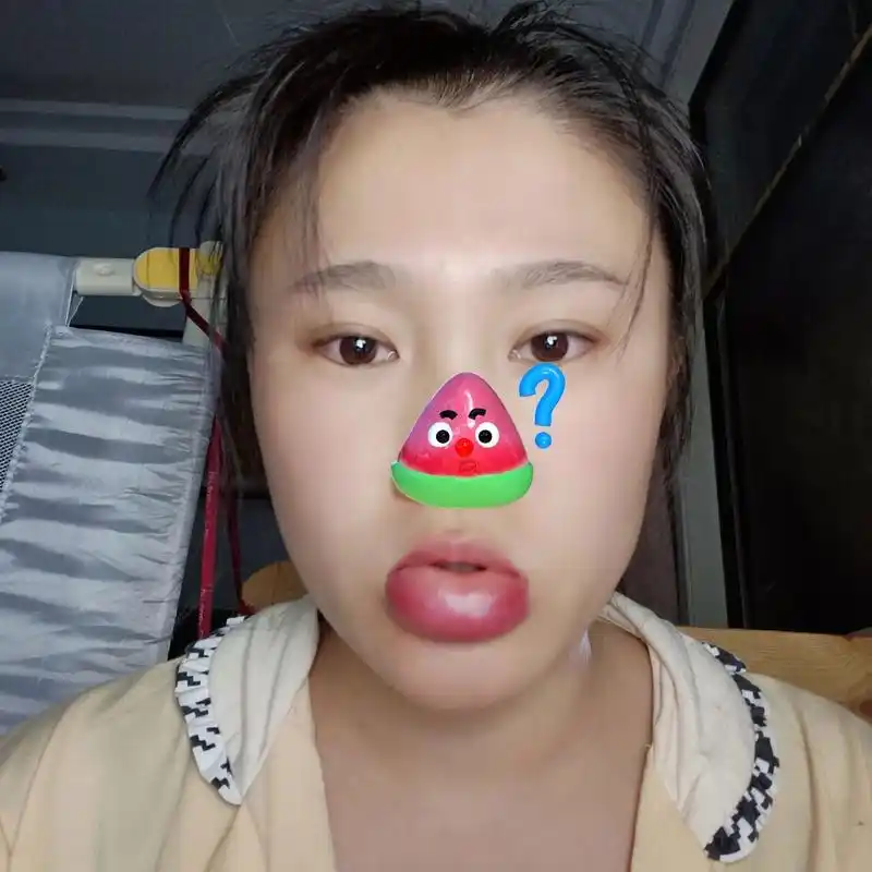 下嘴唇突然肿起来了怎么回事 哈哈笑死我了