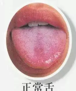 正常的舌头:正常的舌头就和人的体型一样,胖瘦始终,能够灵活转动,整个