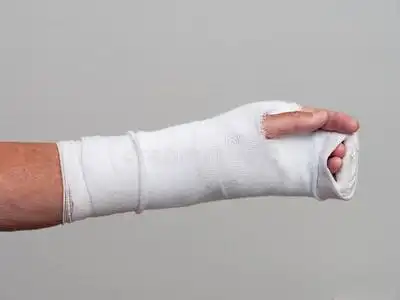 小男孩脚跟骨折用石膏绷带包扎小男孩脚跟骨折用石膏绷带包扎小男孩