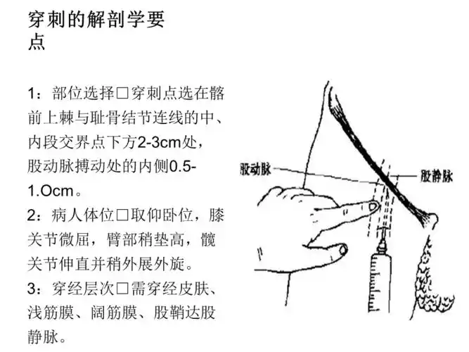股静脉穿刺术ppt012