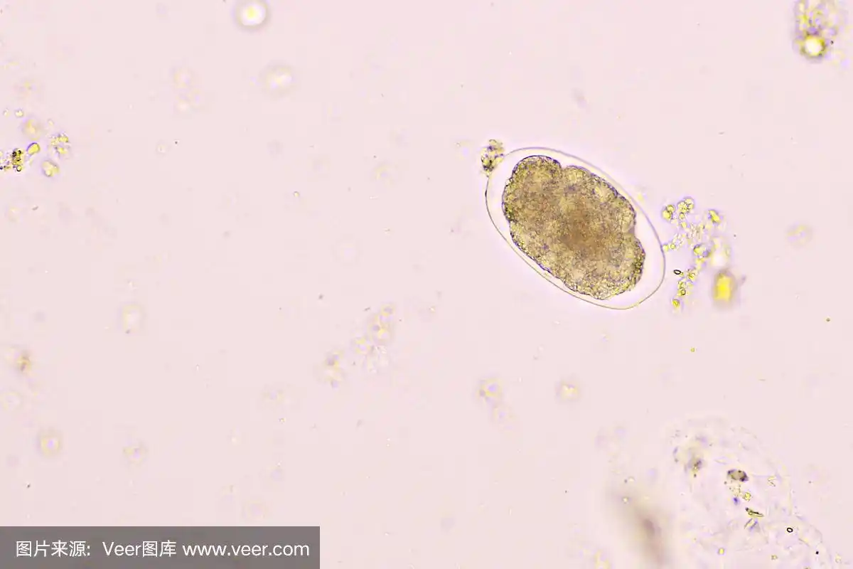 人粪便中钩虫的卵