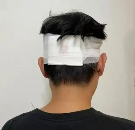 受访者李先生供图:头部受伤流血被包扎