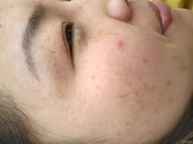 寻常!老年斑仅出现在人体表面吗"安居乐业"-第1张图片-丸子博客