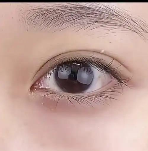 最好看的双眼皮照片