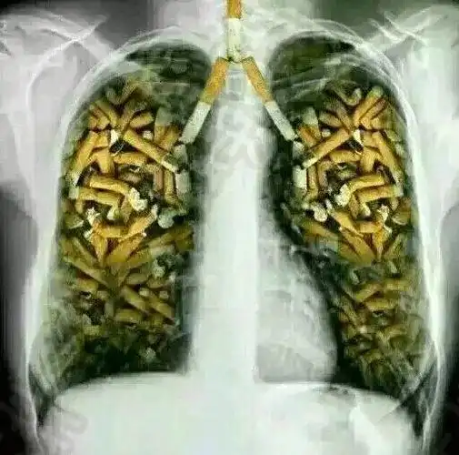 吓屎了……干净抽根烟压压惊