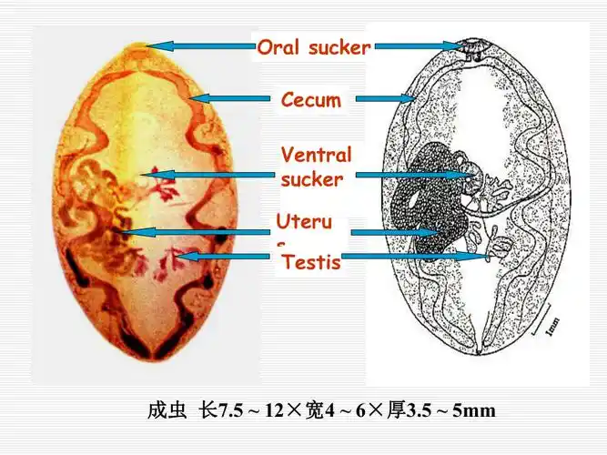 人体生虫学第五节卫氏并殖吸虫
