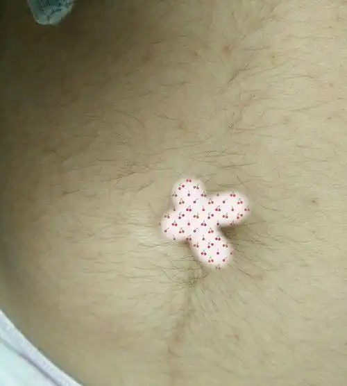 肚子越来越多的毛