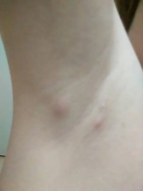 第一天的时候胳膊伸拉就又点疼.请