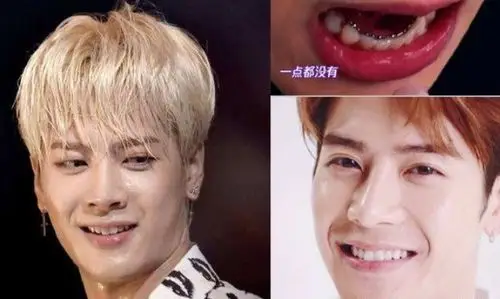 王嘉尔的微笑曲线你满意吗?hi~我是圈内"放大镜"_圈子-新氧美容整形