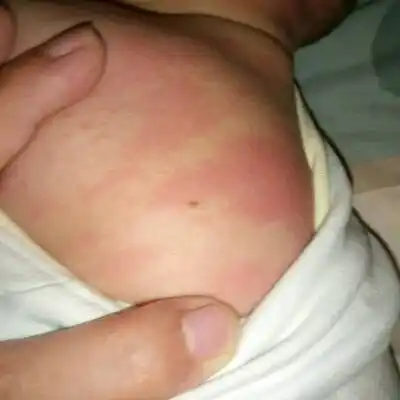 宝宝四个月了今天洗澡突然发现背上长了个黑斑,各位宝妈可以帮我看看