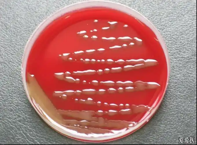 考考你的眼力8--看图识菌-肺炎链球菌